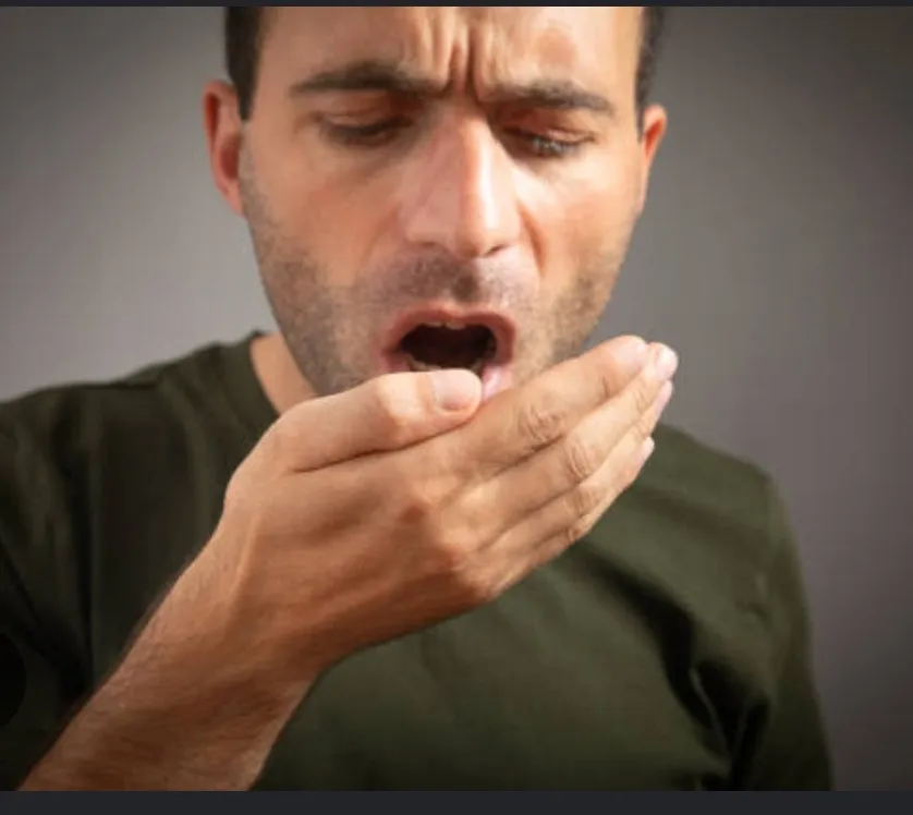 Halitosis (Bad Breath): Causes, Prevention, and Treatment in Meerut