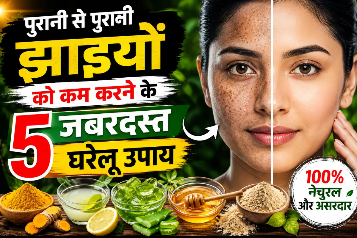 चेहरे पर झाइयां क्यों होती हैं? जानिए कारण, घरेलू उपाय, इलाज और बचाव